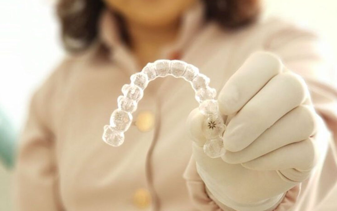 O que é Invisalign? Como funciona?