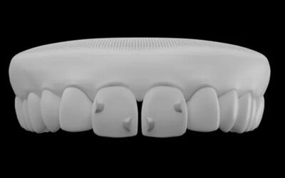 Novidades no tratamento Invisalign