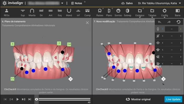 Clincheck mobile (novidades no tratamento Invisalign) Clincheck mobile