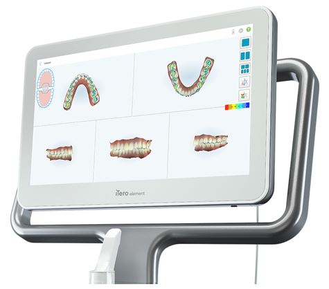 iTero Element 5D iTero Element 5D