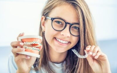 Invisalign ou aparelho fixo?