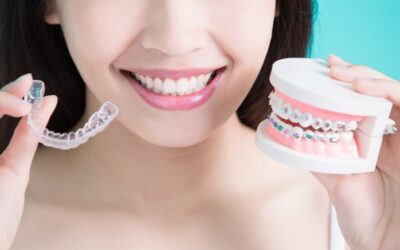 O Invisalign não funciona?