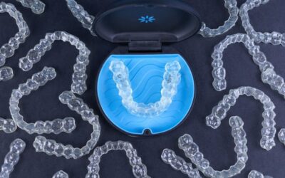 Como são os primeiros dias com os alinhadores Invisalign?