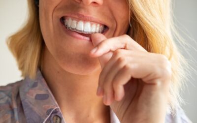 Aparelho invisível: conheça a opção de tratamento com Invisalign