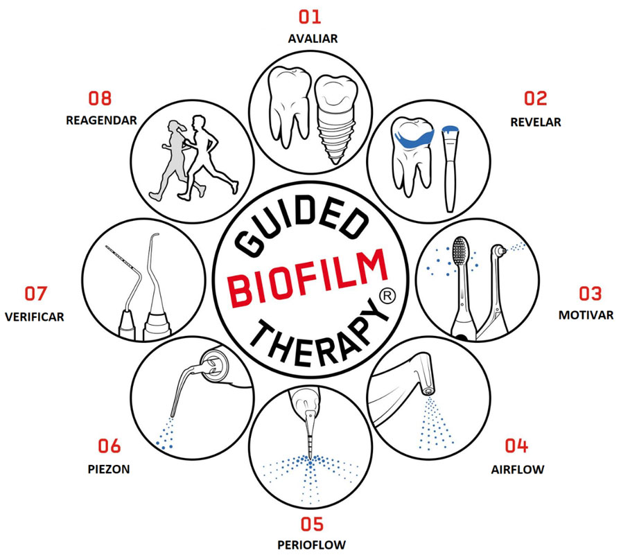 Como é realizada a profilaxia com AirFlow Como é realizada a profilaxia com AirFlow