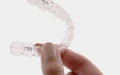 Uso das contenções Vivera no tratamento ortodôntico