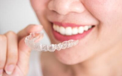 Mitos e verdades sobre os alinhadores Invisalign