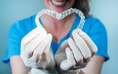 O que você precisa saber sobre Invisalign