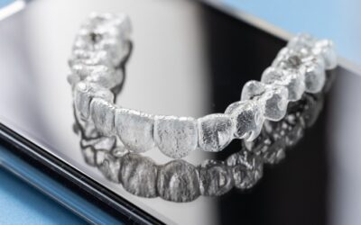 SmartTrack: do que são feitos os alinhadores Invisalign