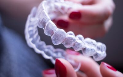 Principais vantagens do Invisalign