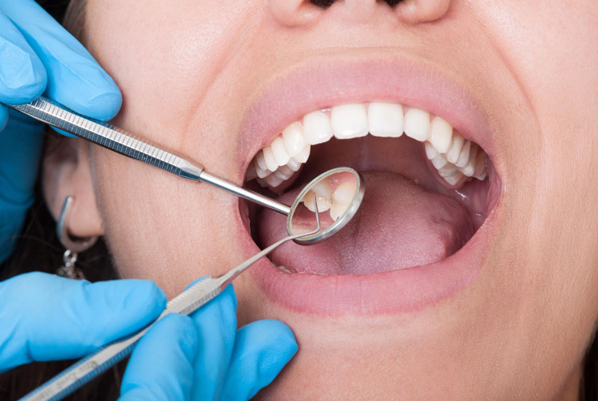 Por que a limpeza dental (profilaxia) é importante para quem tem diabetes? Por que a limpeza dental (profilaxia) é importante para quem tem diabetes?
