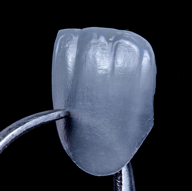 lente de contato dental em São Paulo lente de contato dental em São Paulo