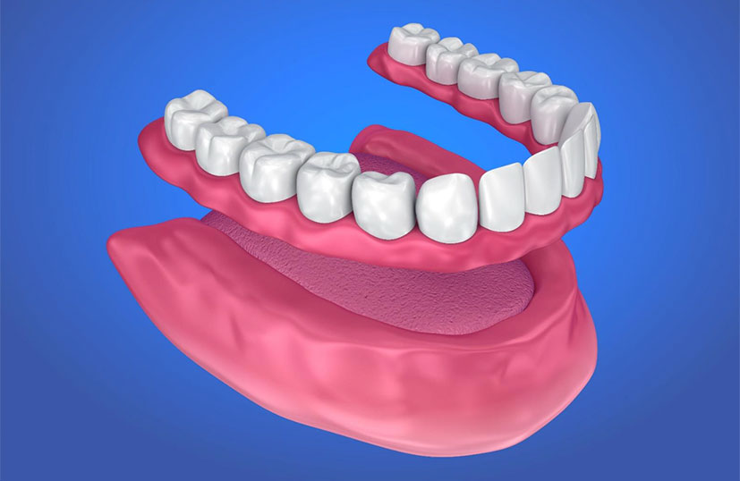 Próteses Totais em São Paulo Próteses Totais em São Paulo