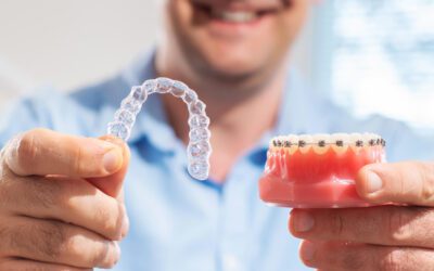 Invisalign é mais caro que o aparelho Fixo?