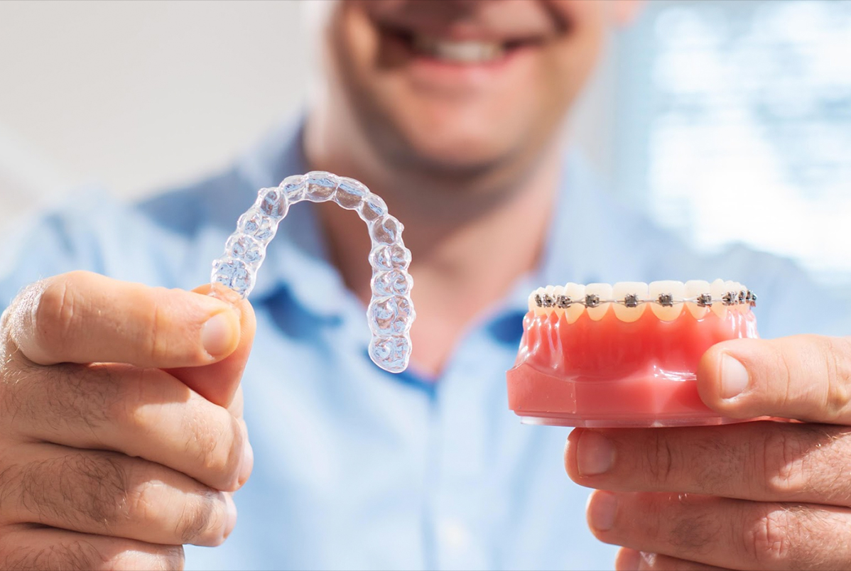 Invisalign é mais caro que o aparelho Fixo? Invisalign é mais caro que o aparelho Fixo?<br />