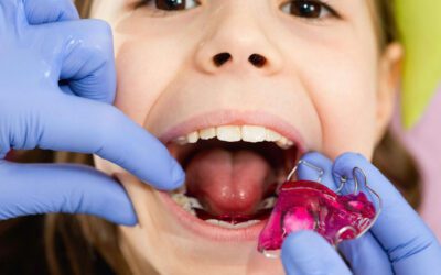 Seu filho precisa de aparelho? Sinais de que você deve procurar um ortodontista