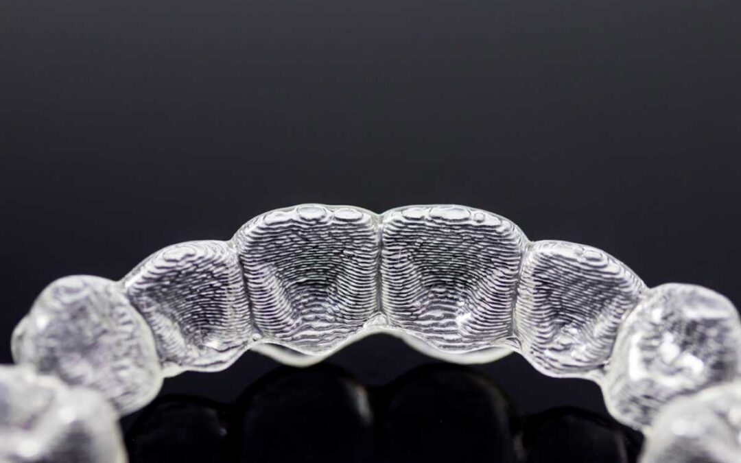 12 perguntas frequentes sobre Invisalign: Tire suas dúvidas antes de começar o tratamento