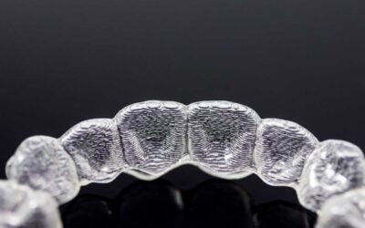 12 perguntas frequentes sobre Invisalign: Tire suas dúvidas antes de começar o tratamento