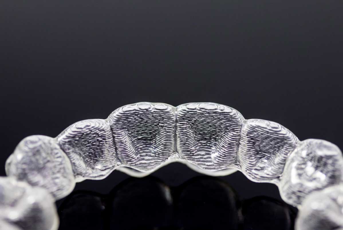 12 perguntas frequentes sobre Invisalign: Tire suas dúvidas antes de começar o tratamento