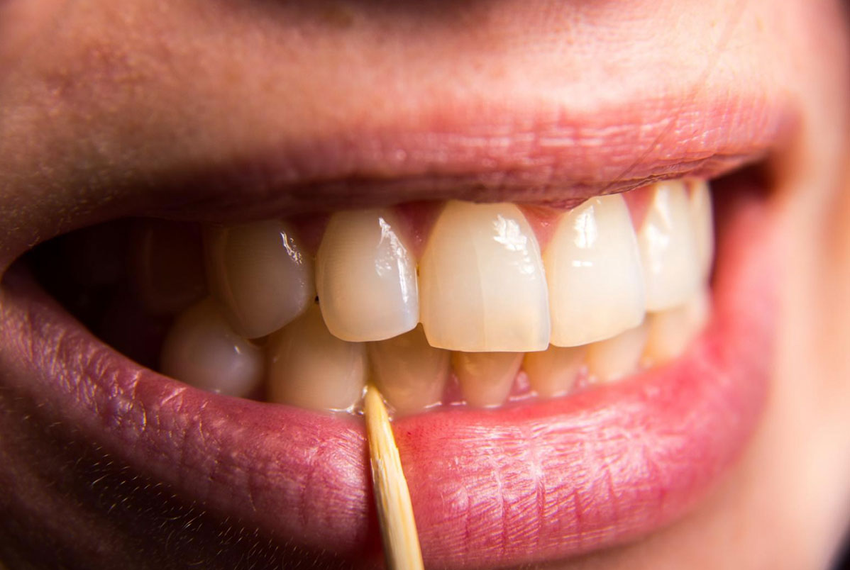Você costuma palitar os dentes? Conheça os prejuízos para sua saúde bucal Você costuma palitar os dentes? Conheça os prejuízos para sua saúde bucal