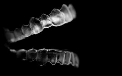 Conheça os dispositivos auxiliares usados no tratamento com Invisalign