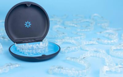 Quantos alinhadores vou usar?