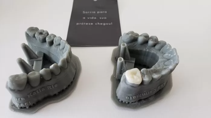 estauração onlay confeccionada a partir do escaneamento 3D – Laboratório Carminato estauração onlay confeccionada a partir do escaneamento 3D – Laboratório Carminato