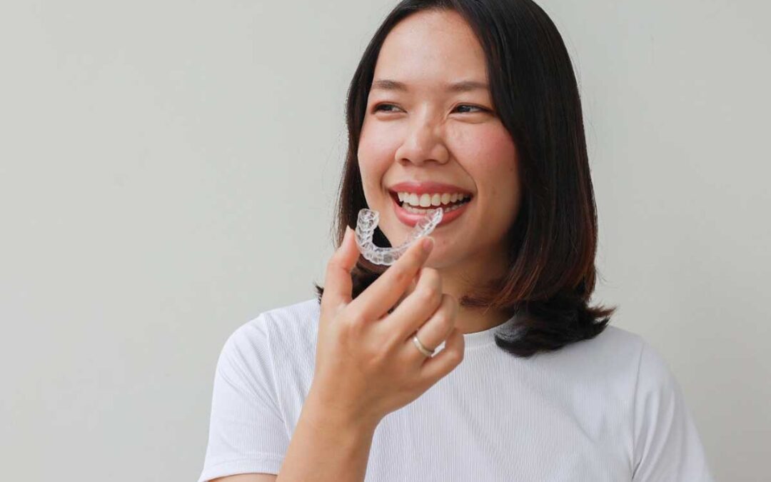 Aparelho lingual pode ser substituído pelo Invisalign?