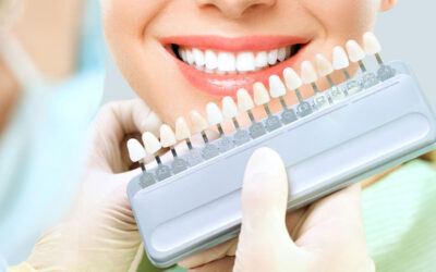 Finalizei o tratamento com Invisalign, mas meus dentes ainda não estão perfeitos: e agora?