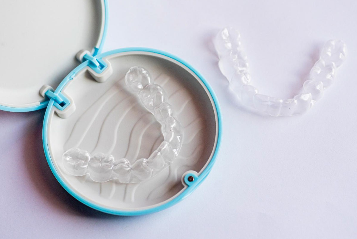 Alinhadores passivos no tratamento com Invisalign