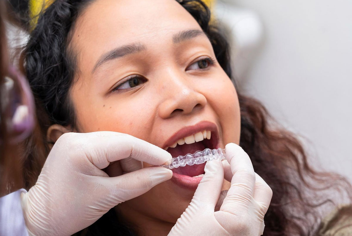 Ortodontia com Invisalign em pacientes periodontais estáveis: é possível tratar com segurança?