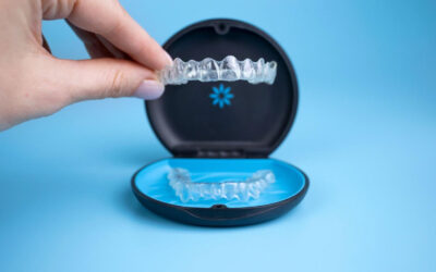 Detalhes que diferenciam um tratamento ortodôntico comum com Invisalign de um tratamento de excelência
