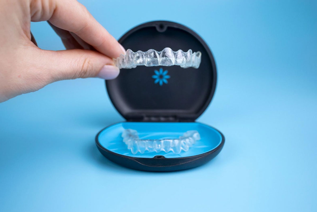 Detalhes que diferenciam um tratamento ortodôntico comum com Invisalign de um tratamento de excelência