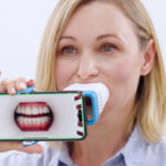 Invisalign Lens: como funciona o acompanhamento virtual do tratamento ortodôntico