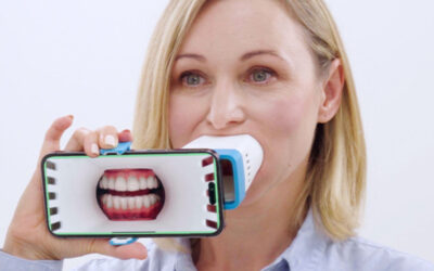 Invisalign Lens: como funciona o acompanhamento virtual do tratamento ortodôntico
