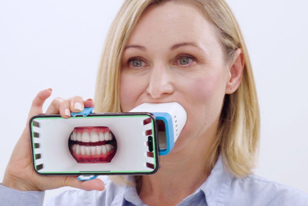 Invisalign Lens: como funciona o acompanhamento virtual do tratamento ortodôntico