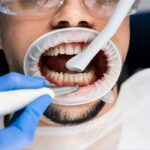 AirFlow para dentes sensíveis: é possível fazer limpeza sem sofrer?